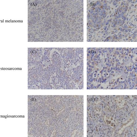 Immunohistochemical Analysis Of Pd L1 In Oral Melanoma Osteosarcoma