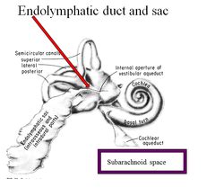 Endolymphatic Duct