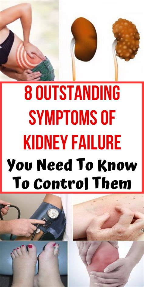 8 Outstanding Symptoms Of Kidney Failure You Need To Know To Control Them