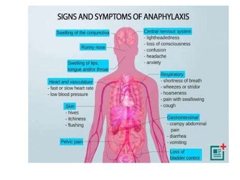 Final anaphylactic reactions and anaphylactic shock