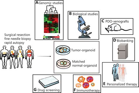 Living Biobank Based Cancer Organoids Prospects And Challenges In