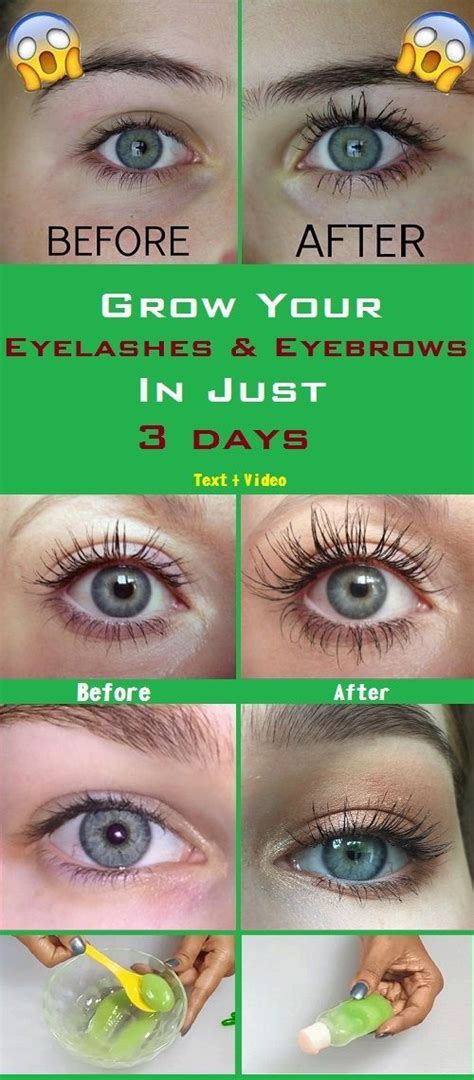 Grow Your Eyelashes And Eyebrows In Just 3 Days Eyelash And Eyebrow Serumvideo Herbal Remedy