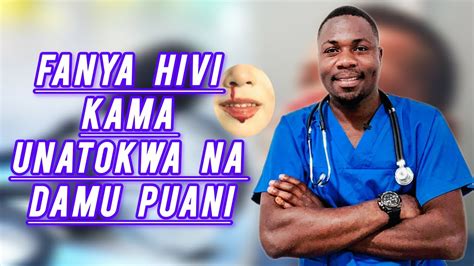 Jinsi Ya Kumsaidia Anaetokwa Na Damu Puani Epistaxis Nose Bleeding