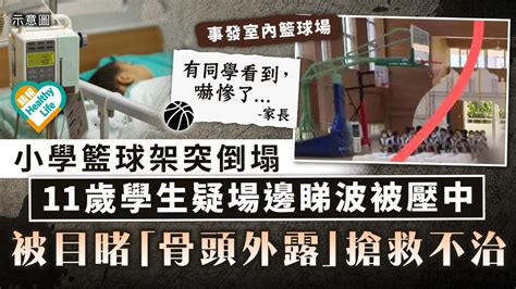 恐怖意外｜內地小學籃球架突倒塌 11歲學生疑場邊睇波被壓中 被目睹「骨頭外露」搶救不治 晴報 健康 生活健康 D230607