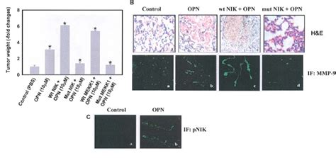 Figure 3 From Osteopontin Stimulates Melanoma Growth And Lung