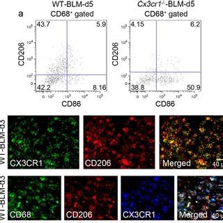 (PDF) Essential involvement of the CX3CL1-CX3CR1 axis in bleomycin ...