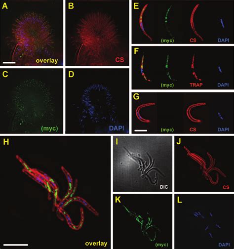 Localization Of UOS3 In Oocyst And Hemolymph Sporozoites UOS3 Was