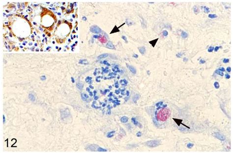 M Microti Tuberculous Lesion In A Field Vole Macrophages And