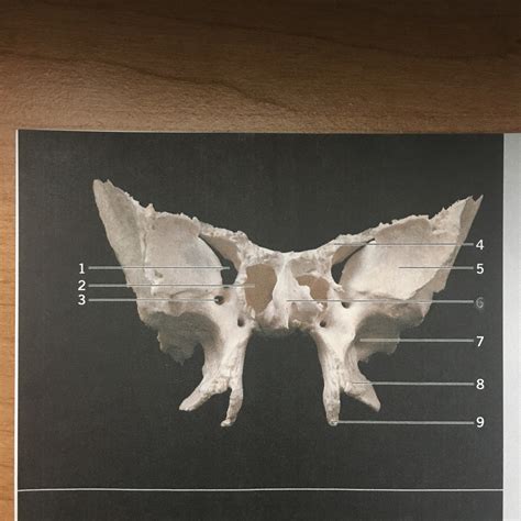 Figure 1 14 Sphenoid Bone Anterior View Diagram Quizlet