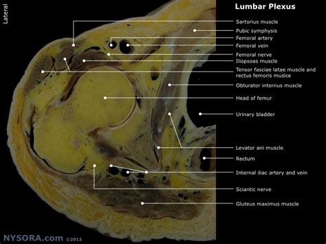 Crossection Lumbar Plexus Nysora Nysora Nysora