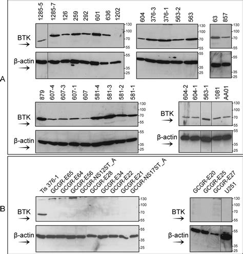 Immunoblotting Analysis Of Bruton Tyrosine Kinase Btk Protein