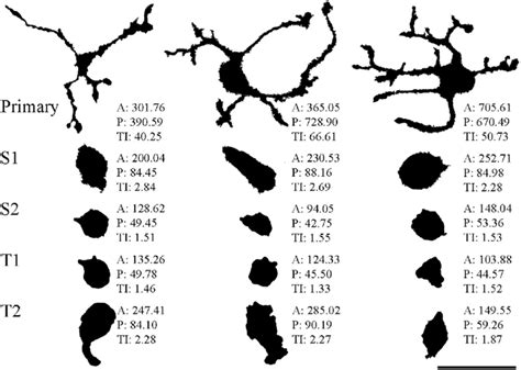 Morphological Heterogeneity Of Microglial Cells In Different Cultures