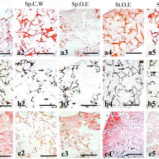 Histological Analysis Of HDPSCs Seeded On Silk Fibroin Scaffolds After