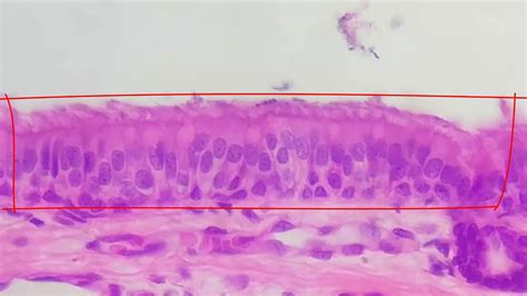 Pseudostratified Columnar Epithelium Youtube