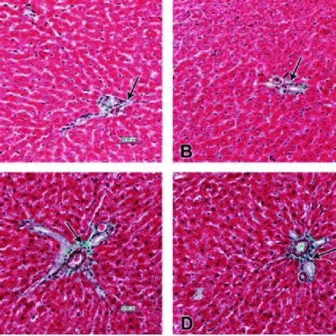 Photomicrographs Of Liver Sections Stained With Massons Trichrome Download Scientific