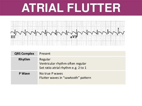 Arrhythmia Recognition And Management