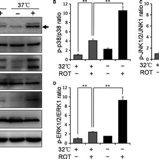 Mild Hypothermia Inhibits Rotinduced Activation Of Mapk Signalling In