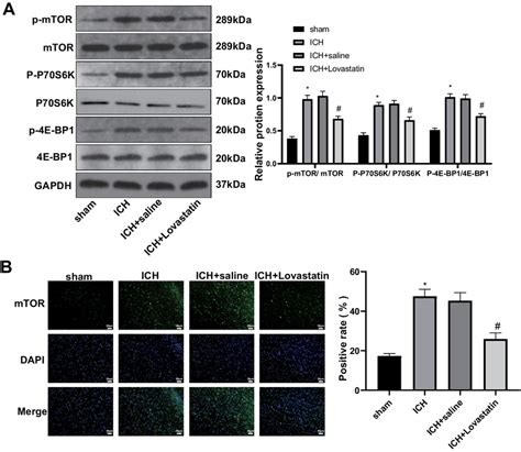 Lovastatin Inhibits Ich Through Blockage Of Ampk Mtor Signaling