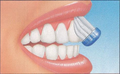 Cuidado Dental T Cnica Del Cepillado