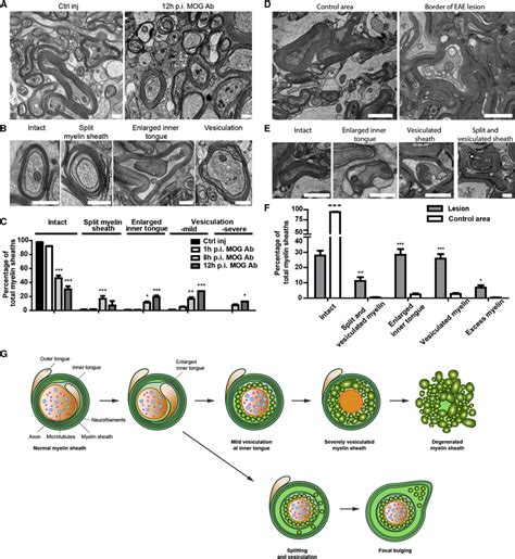 Myelin Fragmentation Patterns In Anti Mog Antibody Injected Lewis Rats