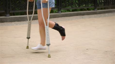 Woman Injured Ankle Walking On Crutches Stock Footage Video 100