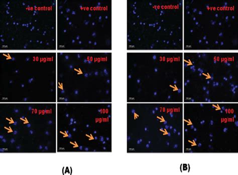 Apoptosis Inducing Activity Of Lc Pis In A549 Cells A Lc Pi I