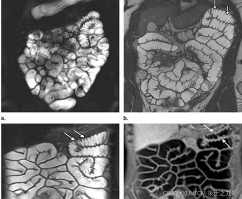 MRI原理与CEST相关简介_cest mri-CSDN博客