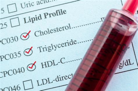 Co To Jest Cholesterol HDL Oraz Jego Normy Niski I Wysoki Cholesterol