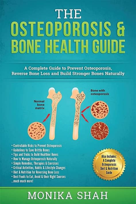 How To Prevent Osteoporosis A Comprehensive Guide Ihsanpedia