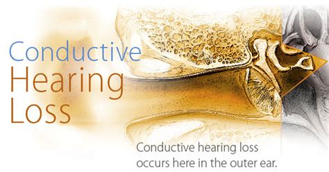 Treatment For Conductive Hearing Loss