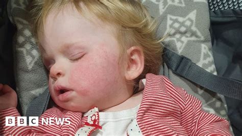 Scarlet Fever Mother S Terror After Late Night Antibiotic Search Bbc News