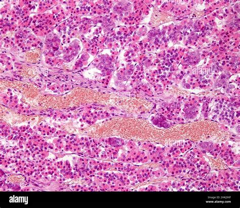Anterior Lobe Of Pituitary Gland Light Micrograph Stock Photo Alamy