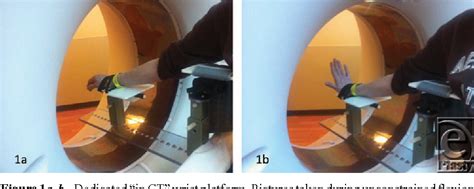 Pdf Kinematic “4 Dimensional” Ct Imaging In The Assessment Of Wrist