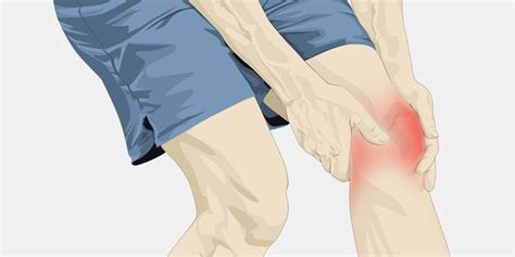 Fluid In Knee The Complete Injury Guide Vive Health