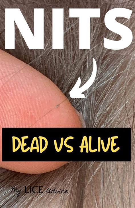 Head Lice Pictures In Blonde Hair