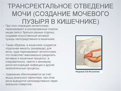 Искусственный мочевой пузырь - online presentation