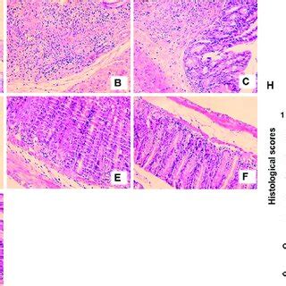 Effects Of Anemoside B B On Histopathological Changes Of Colonic