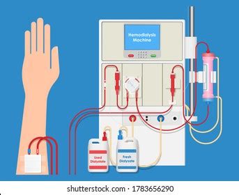 162 Apheresis Images, Stock Photos, 3D objects, & Vectors | Shutterstock