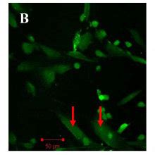 Immunofluorescence Staining Of HAECs With CD31 In Various Groups The