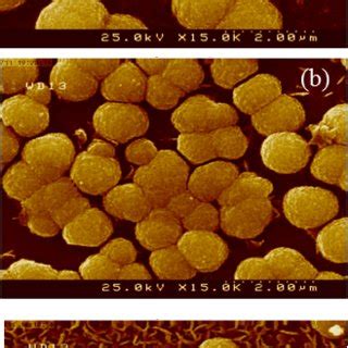 SEM Images Of CdSe Thin Films Deposited At A PH 11 23 B PH 11 90