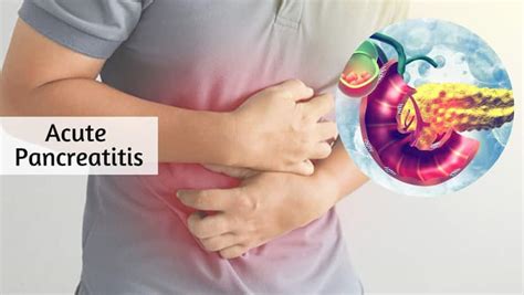 Acute Pancreatitis 7 Symptoms That Says Your Pancreas Are Not Working Properly