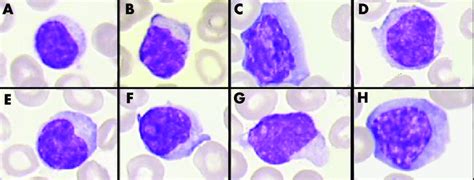 Examples Of The Different Lymphocytes Lymphocytes Classified As A Download Scientific