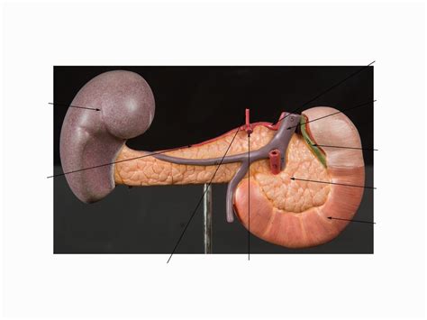 Pancreas Duodenum And Spleen Model Posterior View Diagram Quizlet