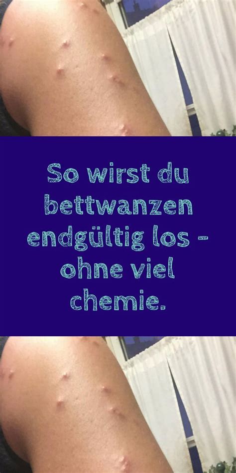 Stielwarzen Behandlung Ursachen Symptome Artofit