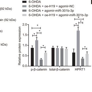 Overexpressed HPRT1 activates the Wnt β catenin signaling pathway in a