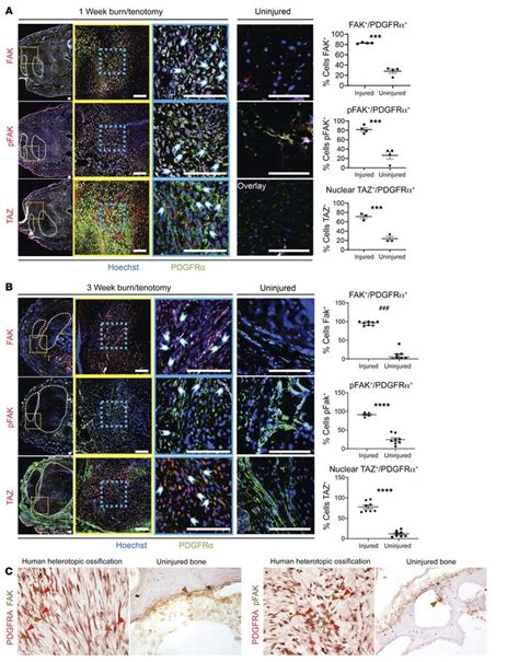 Jci Immobilization After Injury Alters Extracellular Matrix And Stem