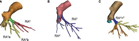 Figure 1 From An Atlas Of Anatomical Variants Of Subsegmental Pulmonary