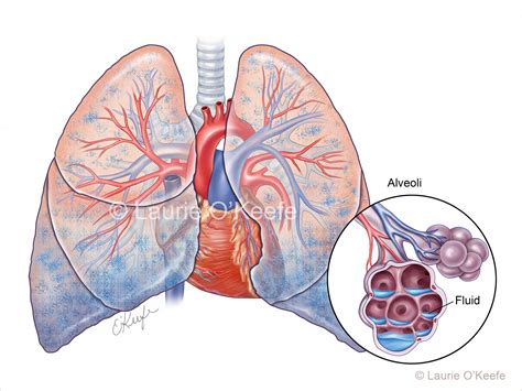 Wet Lungs Archives Laurie Okeefe Illustration