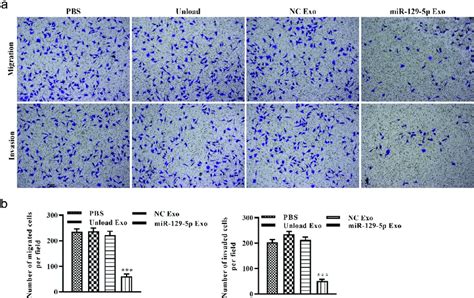 Effect Of Mir 129 5p Loaded Exosomes On Tumor Cell Migration And