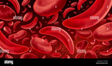 Sickle Cell Anemia As A Red Blood Disease As A Normal And Abnormal